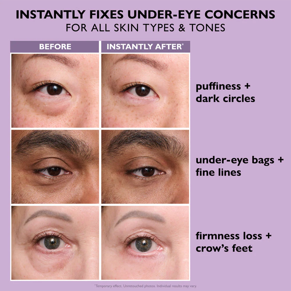 OcuTight™ Instant Eye Tightener